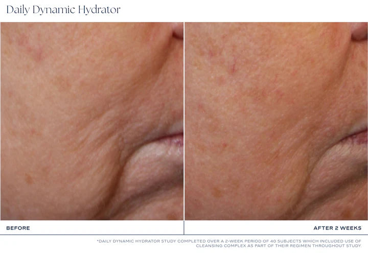 iS Clinical Daily Dynamic Hydrator- kosteuttava anti-age voide 50ml