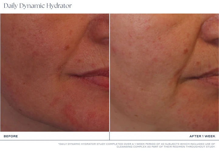 iS Clinical Daily Dynamic Hydrator- kosteuttava anti-age voide 50ml